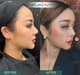 Slider image (8) Thailand Plastic Surgeon - Dr. Oumyos Rattanamahattana